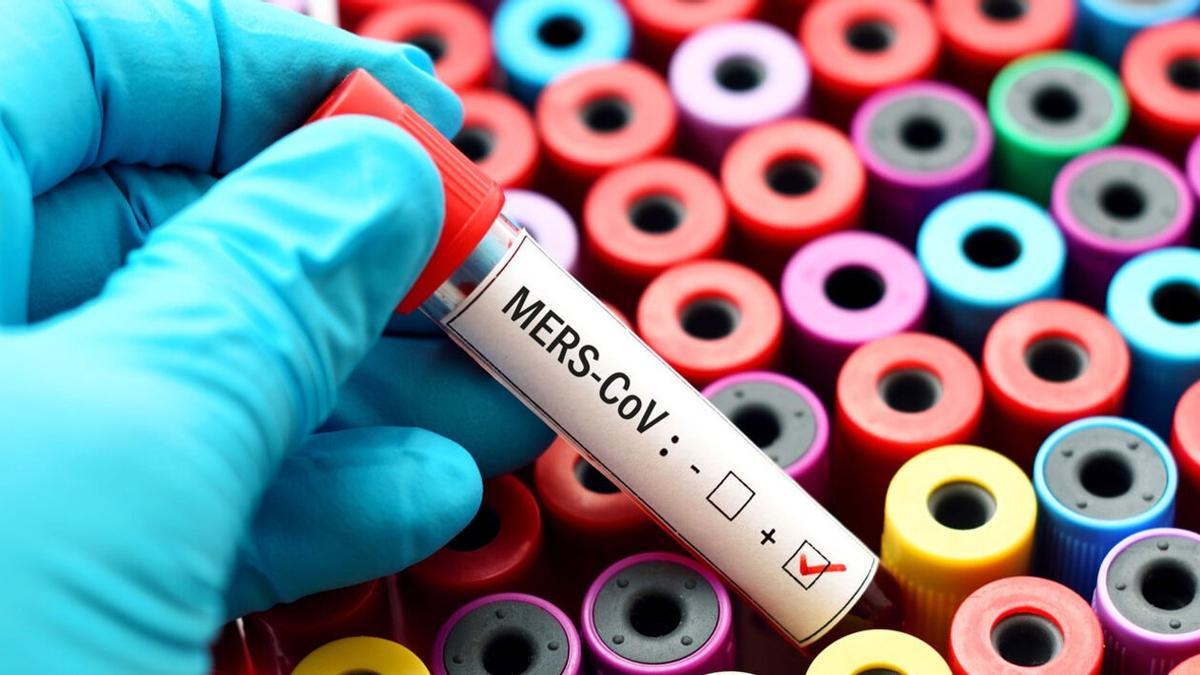 إصابة رجل بفيروس ميرس كوف MERS-CoV