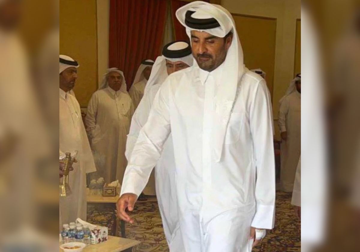ظهر بوجه شاحب.. جرح في يد أمير قطر يلفت الأنظار ويُقلق القطريين