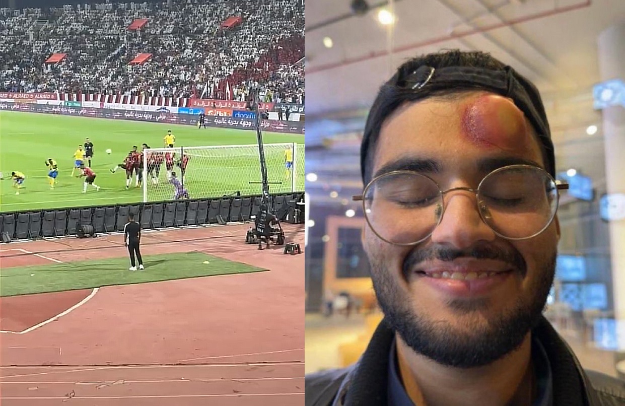 تسديدة رونالدو تصيب مصور مباراة النصر والرائد