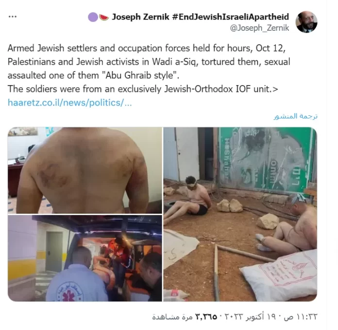 ضرب وحرق وتبول واغتصاب.. جنود ومستوطنون إسرائيليون ينكلون بثلاثة فلسطينيين