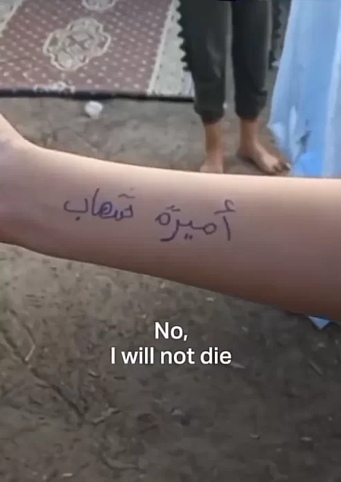 كثير من أطفال غزة كتبوا أسماءهم على أجسادهم