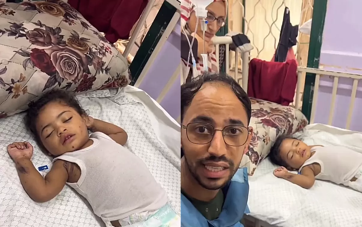 ميليسيا، طفلة مصابة ترقد في أحد المستشفيات جراء غارة إسرائيلية، بعدما فقدت 70 شخصا من عائلتها في غزة