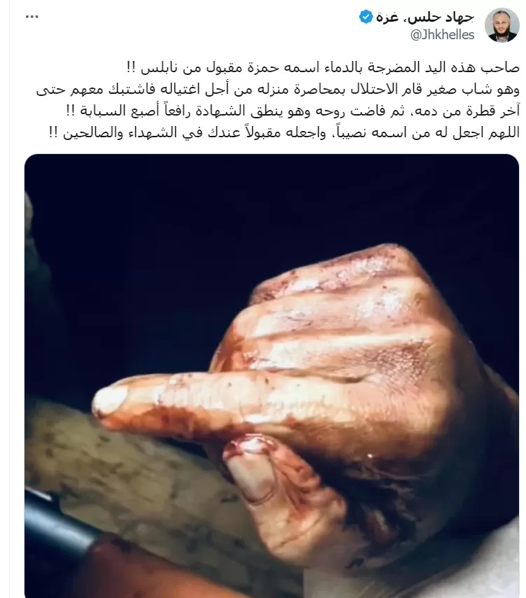 يد الشهيد حمزة مقبول من نابلس