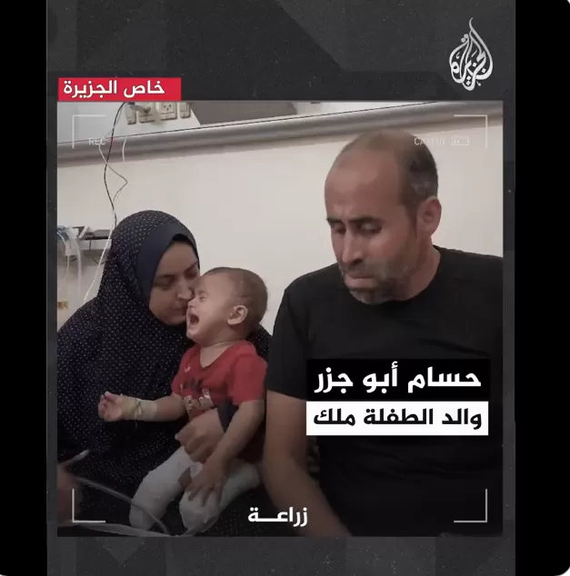 الطفلة الفلسطينية "ملك حسام أبو جزر" ذات العامين فقدت ساقيها جراء غارة إسرائيلية قصفت منزل أسرتها في 17 أكتوبر