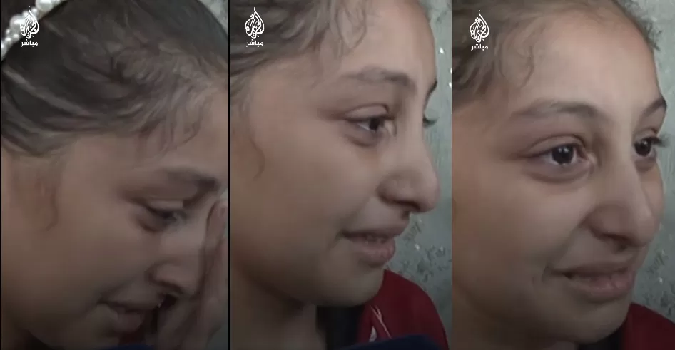 طفلة فلسطينية تبكي بسبب الأوضاع في غزة