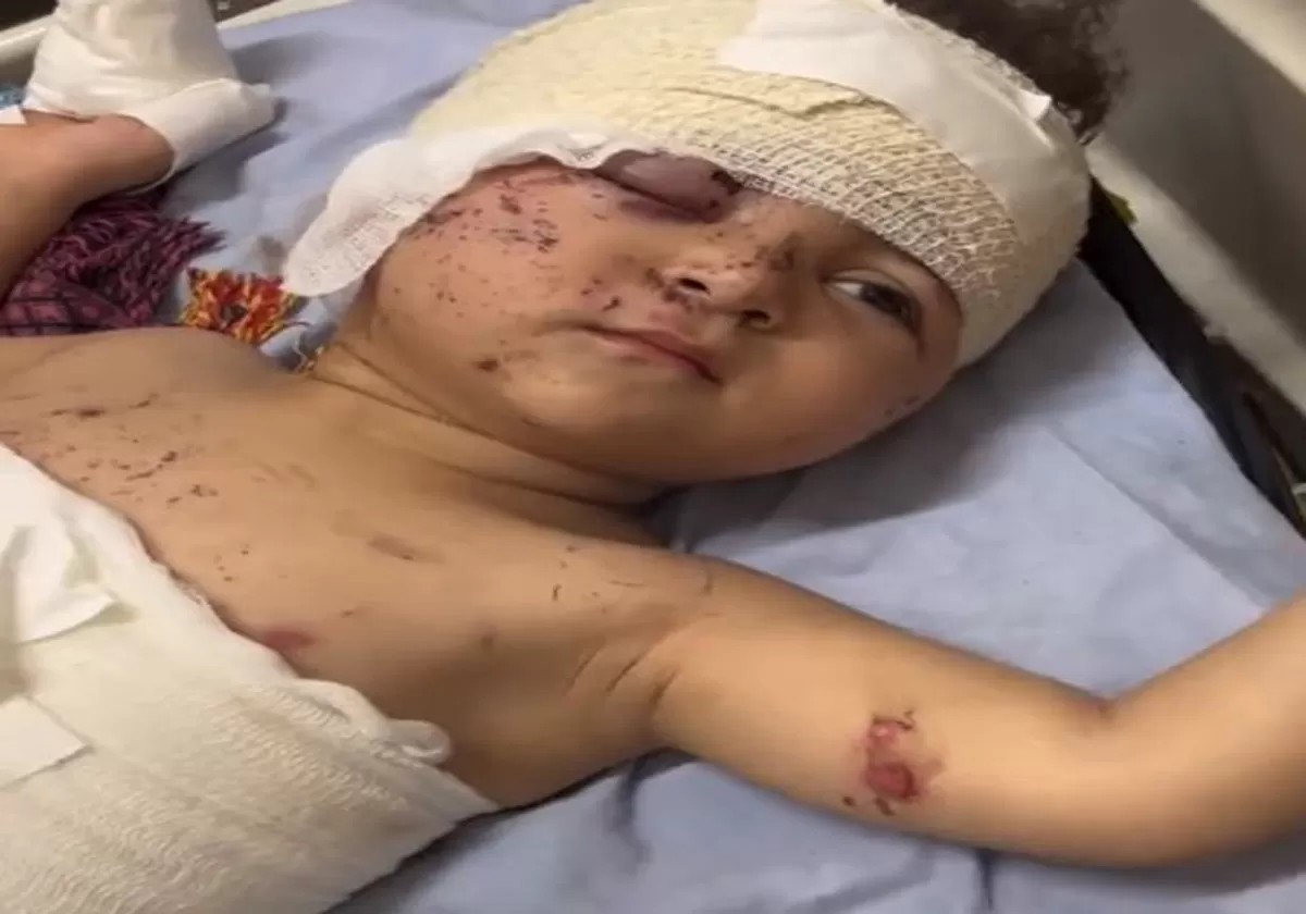 طفلة فلسطينية مصابة بدون أهلها في مشفى الشفاء بغزة