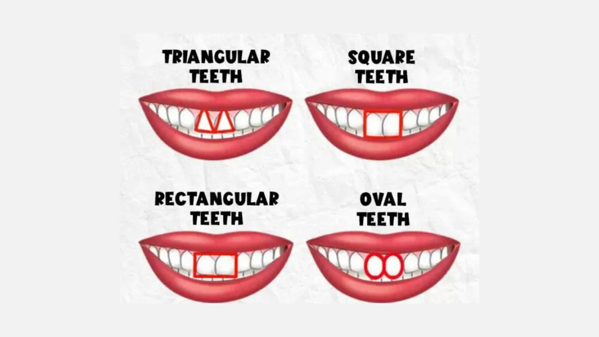 مفاجأة لأصحاب الأسنان المثلثة.. لن تصدق ما يمكن لشكل أسنانك أن يكشفه عن شخصيتك