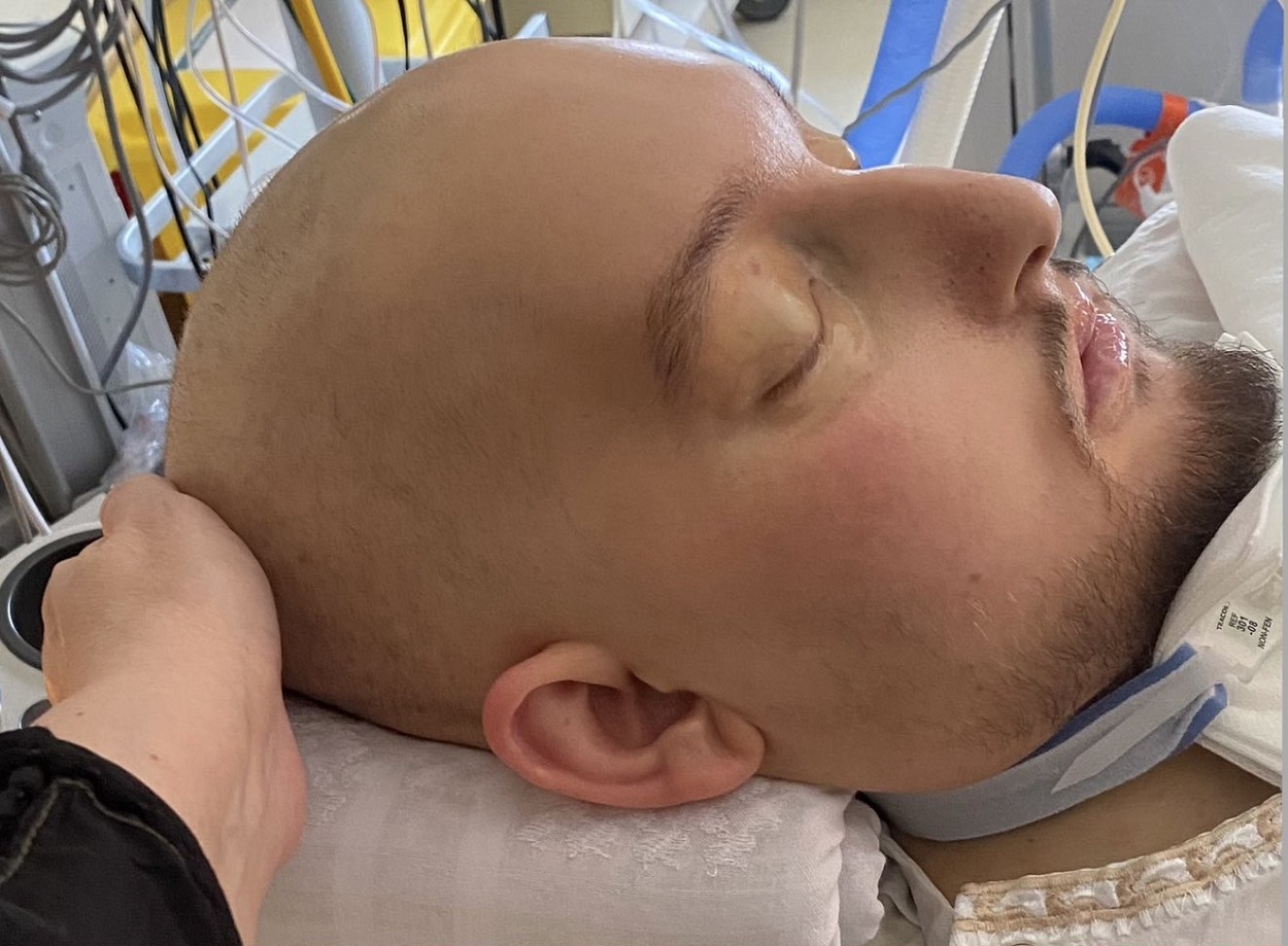 الأمير النائم في أحدث صورة بعد مرور 20 عاماً على وجوده في المستشفى