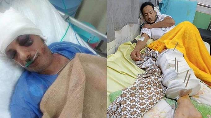 إصابة بالغة للشابين