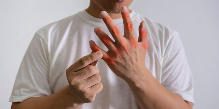 خفض حمض اليوريك خلال 3 أسابيع.. 4 عادات يومية يوصي بها أطباء الروماتيزم للوقاية من النقرس تعرّف إلى 4 عادات يومية يوصي بها أطباء الروماتيزم لخفض حمض اليوريك خلال 3 أسابيع، من تقليل السكريات والكحول إلى تحسين الترطيب والبروتينات.